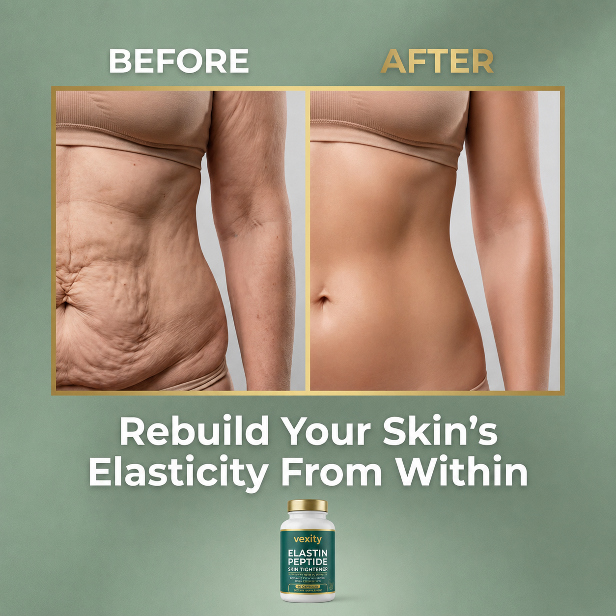 Elastin Peptide Skin Tightening Formula
